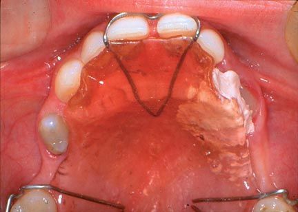 Australian Endodontic Newsletter